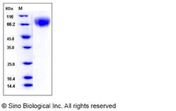 Sino Biological Mouse LAMP2 / CD107b Protein (His Tag) 100ug, Quantity: