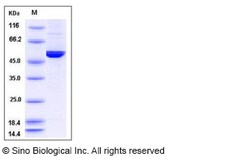 Sino Biological Recombinant Mouse DOPA Decarboxylase/DDC Protein (His Tag),