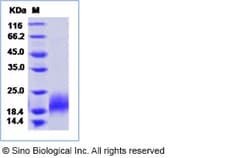 Sino Biological Recombinant Mouse PDGF-B Protein (His Tag), Quantity: Each