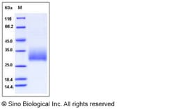 Sino Biological Recombinant Mouse Klrb1a Protein (His Tag), Quantity: Each