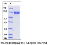Sino Biological Mouse TNFRSF4 / OX40 / CD134 Protein (Fc Tag) 100ug, Quantity: