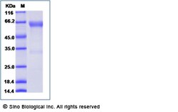 Sino Biological Recombinant Mouse OX40/TNFRSF4 Protein (rFc Tag), Quantity:
