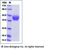 Sino Biological Recombinant Mouse OX40/TNFRSF4 Protein, Quantity: Each