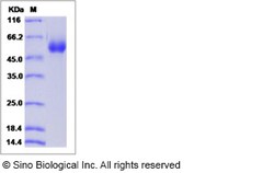 Sino Biological Mouse CD123 / IL3RA Protein (ECD, His Tag) 100ug, Quantity: