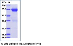 Sino Biological Mouse CD137 / 4-1BB / TNFRSF9 Protein (soluble form, rFc