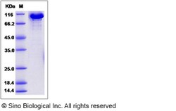 Sino Biological Recombinant Mouse Transferrin Protein (hFc Tag), HPLC-verified,