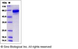 Sino Biological Recombinant Mouse Transferrin Protein (His Tag), Quantity: