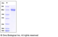 Sino Biological Mouse EphA1 / EPH receptor A1 Protein (His Tag) 100ug,