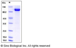 Sino Biological Recombinant Mouse DDR1 Protein (hFc Tag), Quantity: Each