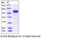 Sino Biological Recombinant Mouse DDR1 Protein (His Tag), HPLC-verified,