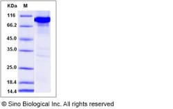 Sino Biological Mouse CAMK4 / CaMKIV Protein (His & GST Tag) 50ug, Quantity: