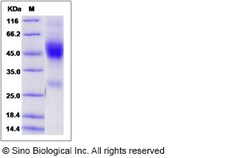 Sino Biological Recombinant Mouse NXPH1 Protein (His Tag), Quantity: Each