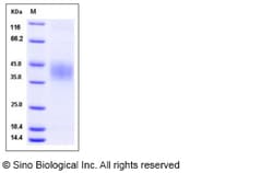 Sino Biological Recombinant Mouse EPCR Protein (His Tag), HPLC-verified,