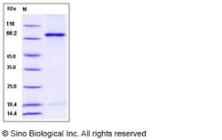 Sino Biological Recombinant Mouse NEK3 Protein (His & GST Tag), Quantity: