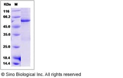 Sino Biological Mouse CDC2 Kinase / CDK1 Protein (His & GST Tag) 50ug,
