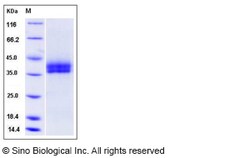 Sino Biological Recombinant Mouse Kallikrein 11 Protein (His Tag), Quantity: