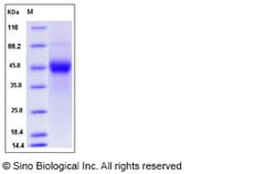 Sino Biological Mouse TROP2 / TACSTD2 Protein (His Tag) 100ug, Quantity: