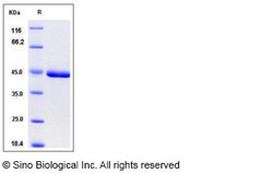 Sino Biological Mouse CHI3L1 / YKL40 / gp39 Protein (His Tag) 100ug, Quantity:
