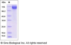 Sino Biological Recombinant Mouse Nicastrin Protein (His Tag), Quantity: