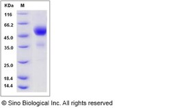 Sino Biological Recombinant Mouse TIGIT Protein (hFc Tag), Quantity: Each