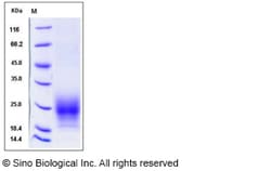 Sino Biological Recombinant Mouse TIGIT Protein (ECD, His Tag), HPLC-verified,