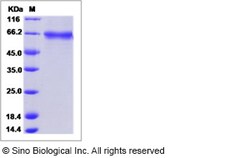 Sino Biological Mouse LRRTM4 Protein (His Tag, ECD) 50ug, Quantity: Each
