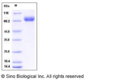 Sino Biological Mouse BCAM Protein (His Tag) 100ug, Quantity: Each of 1