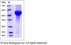 Sino Biological Recombinant Mouse GLA/alpha-Galactosidase A Protein (His