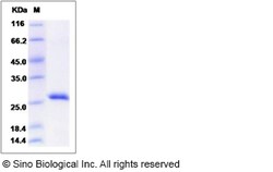 Sino Biological Mouse RPE / RPE2-1 Protein (His Tag) 100ug, Quantity: Each