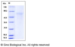 Sino Biological Mouse NGFR / P75 Protein (His Tag) 100ug, Quantity: Each
