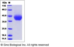 Sino Biological Mouse B7-H3 / CD276 Protein (ECD, His Tag) 100ug, Quantity: