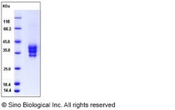 Sino Biological Mouse ESAM / Endothelial Cell Adhesion Molecule Protein