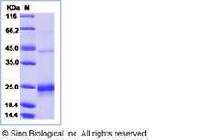 Sino Biological Recombinant Mouse LIGHT/TNFSF14 Protein (His Tag), Quantity: