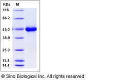Sino Biological Mouse WIF1 / WIF-1 Protein (His Tag) 100ug, Quantity: Each