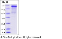 Sino Biological Recombinant Mouse Cadherin-6/K-cadherin Protein (His Tag),