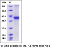 Sino Biological Mouse S100B / S100beta Protein (Fc Tag) 100ug, Quantity: