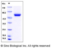 Sino Biological Recombinant Mouse Carboxypeptidase M Protein (His Tag),