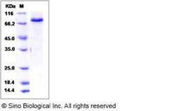 Sino Biological Human / Mouse / Rat SMAD3 Protein (His & GST Tag) 100ug,
