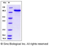 Sino Biological Mouse MFI2 / CD228 / melanotransferrin Protein (His Tag)