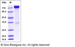 Sino Biological Recombinant Mouse VEGFR2/KDR Protein (hFc Tag), Quantity: