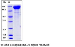 Sino Biological Recombinant Mouse VEGFR2/KDR Protein (His Tag), Quantity: