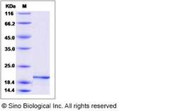 Sino Biological Recombinant Mouse Pleiotrophin/PTN Protein, Quantity: Each