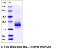 Sino Biological Recombinant Mouse TFPI2 Protein (His Tag), Quantity: Each
