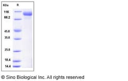 Sino Biological Mouse HER3 / ErbB3 Protein (His Tag) 100ug, Quantity: Each