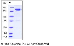 Sino Biological Mouse IL12B / IL-12B Protein (Fc Tag) 50ug, Quantity: Each