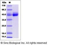 Sino Biological Recombinant Mouse IL-12 p40/IL12B Protein, Quantity: Each