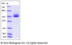 Sino Biological Recombinant Mouse Prostatic Acid Phosphatase/ACPP Protein