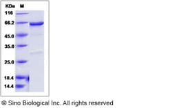 Sino Biological Recombinant Mouse PDK4 Protein (His & GST Tag), Quantity: