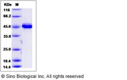 Sino Biological Recombinant Mouse AKT3 Protein (aa 106-479), Quantity: