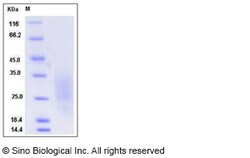 Sino Biological Recombinant Mouse LAIR1 Protein (His Tag), Quantity: Each